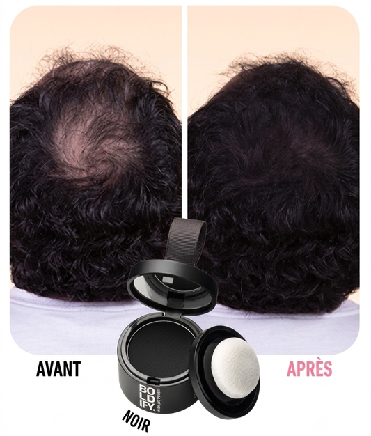 Cache ta calvitie en 10 secondes seulement — Pour hommes & femmes ✨